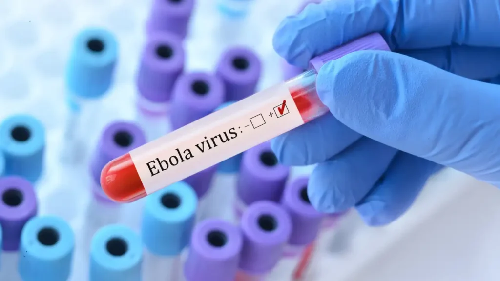 Health officials in France confirming the country’s first-ever Ebola virus disease case linked to a doctor returning from the Democratic Republic of Congo.